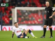 The Impact of Fixture Congestion on Player Injuries Fixture Congestion Impact on Football Player Injuries